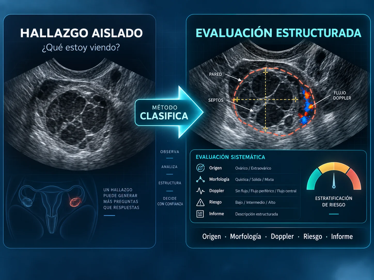 Del hallazgo aislado a una evaluación estructurada de masas anexiales